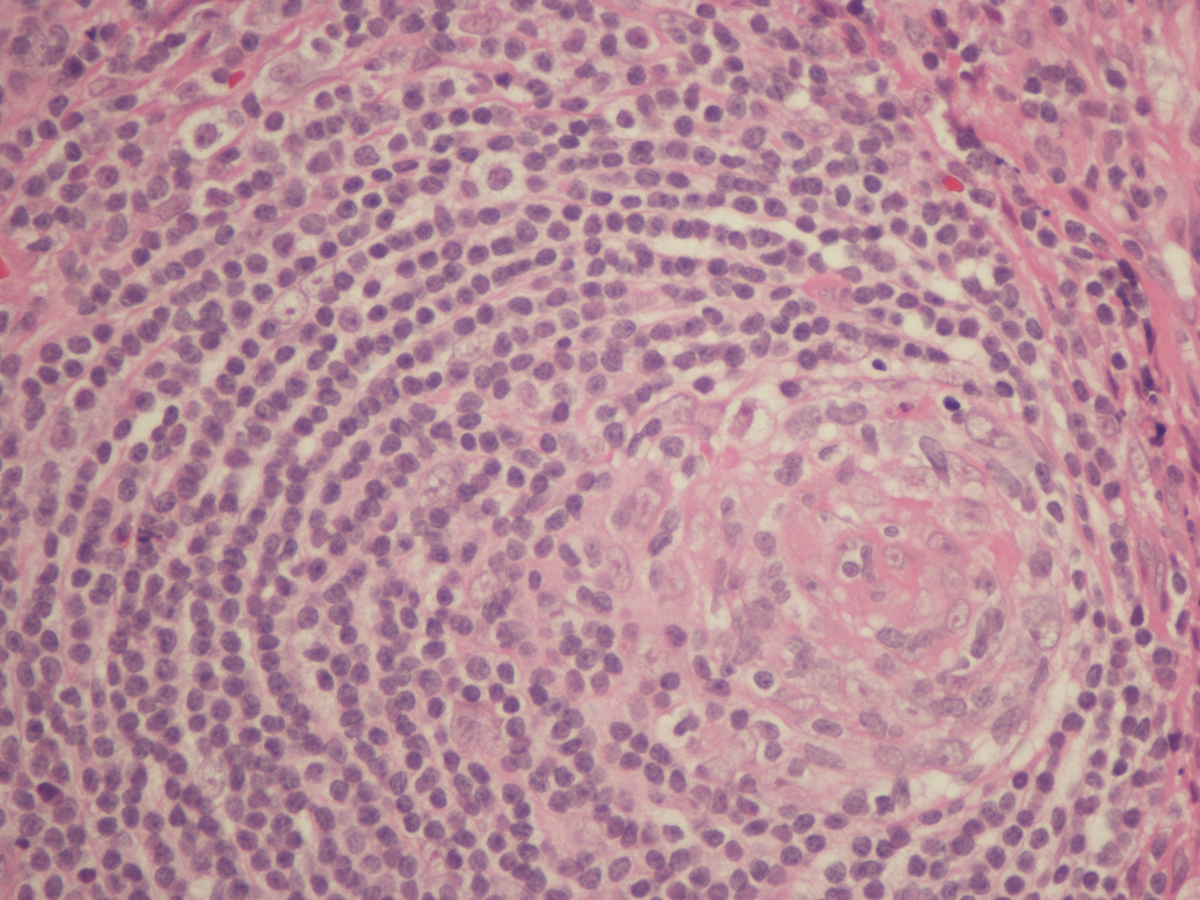 HV-CD 40X
